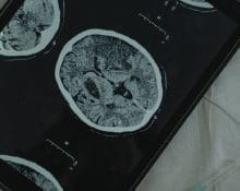 Apakah CT Scan Ditanggung BPJS, Ini Syarat dan Prosedur Pengajuannya