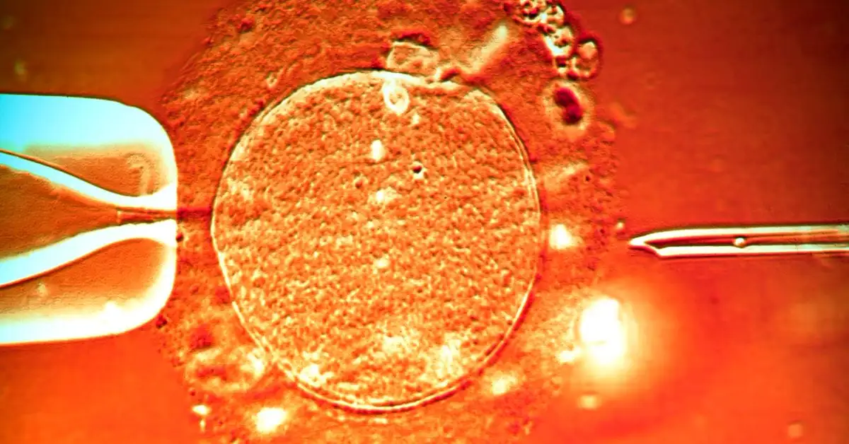 Belum Mendapatkan Momongan, Program Bayi Tabung (IVF) Solusinya!