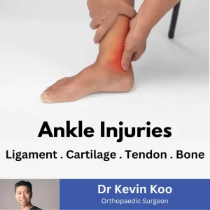 Dr Kevin Koo Ankle Injury SKU