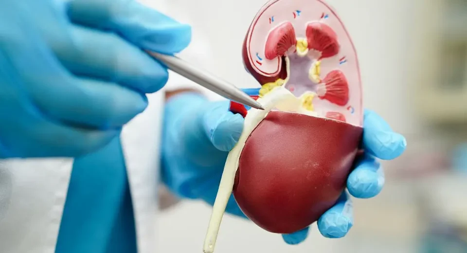 Penyakit Urologi & Masalah Ginjal, Ureter, serta Kandung Kemih