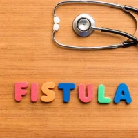 Operasi Laser Fistula Ani