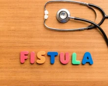 Operasi Laser Fistula Ani
