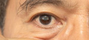 eye-health-300x134-1