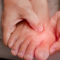 Biaya Operasi Bunion di Singapura