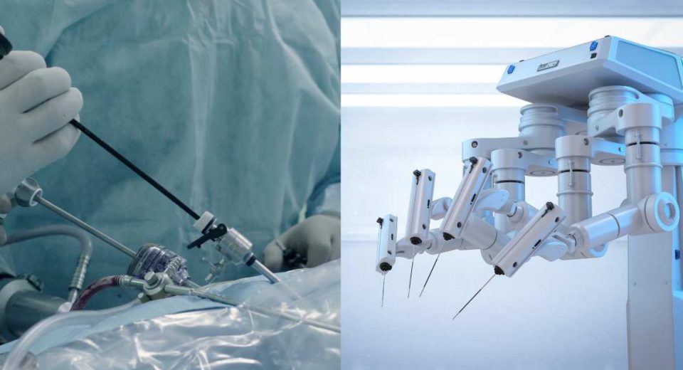 Operasi Laparoskopi Vs Operasi Robotik
