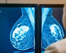Hasil-Mamogram-Mencurigakan-1024x536