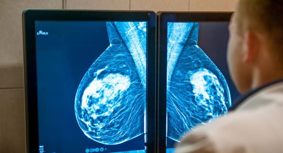 Hasil-Mamogram-Mencurigakan-1024x536