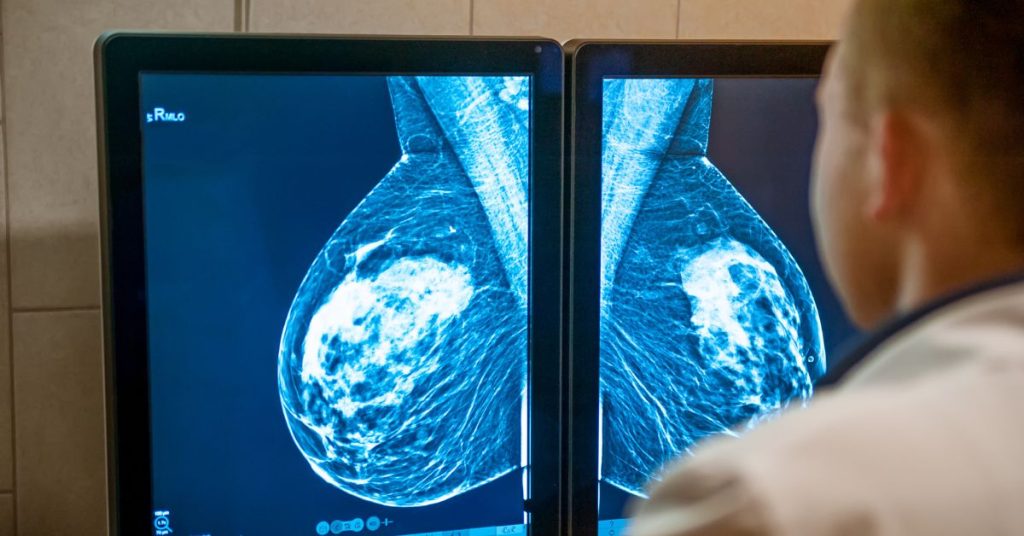Hasil-Mamogram-Mencurigakan-1024x536