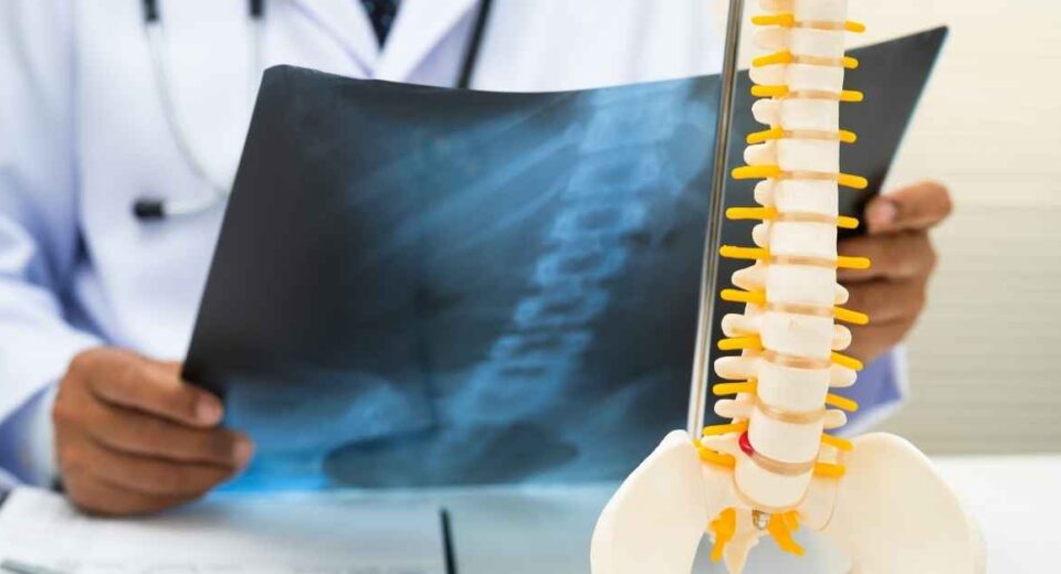 Dokter mengamati hasil rontgen tulang belakang pasien.
